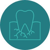 Endodontics Root Canal Dentist Southport - endodontics root canal