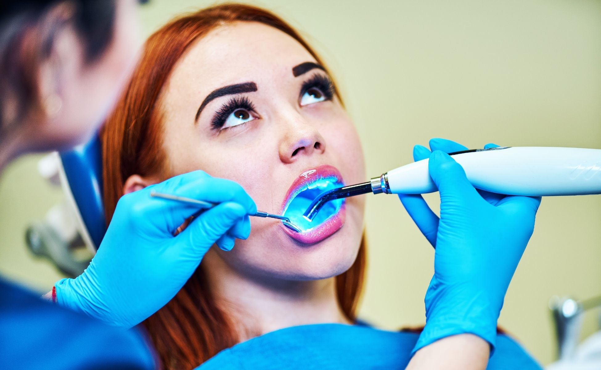 Dental Fillings and Restorations Southport - Starbright Dental Dentist Gold Coast