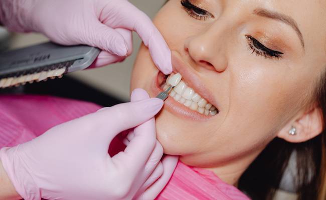Dental Veneers - Starbright Dental Southport Gold Coast