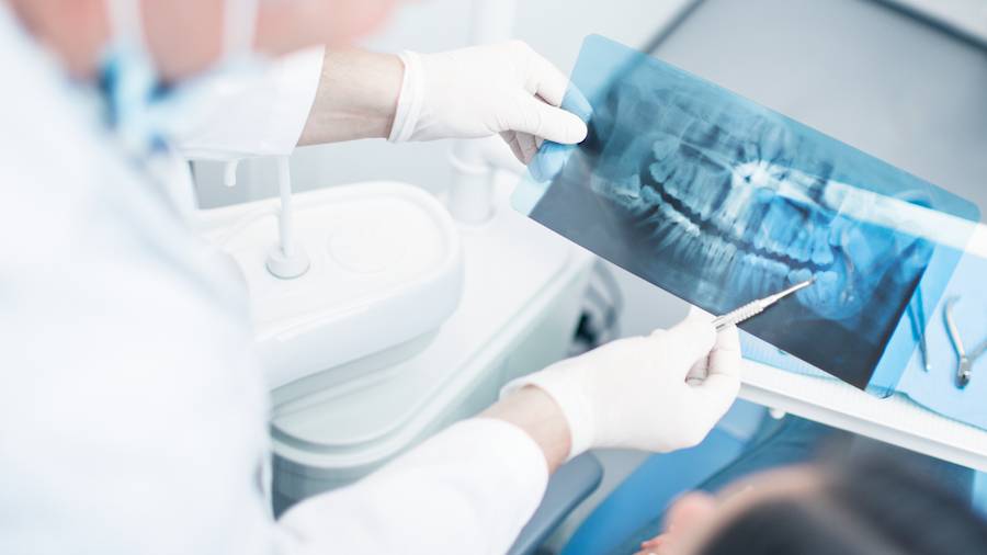 Starbright-Dental-Dental-XRay-Blog