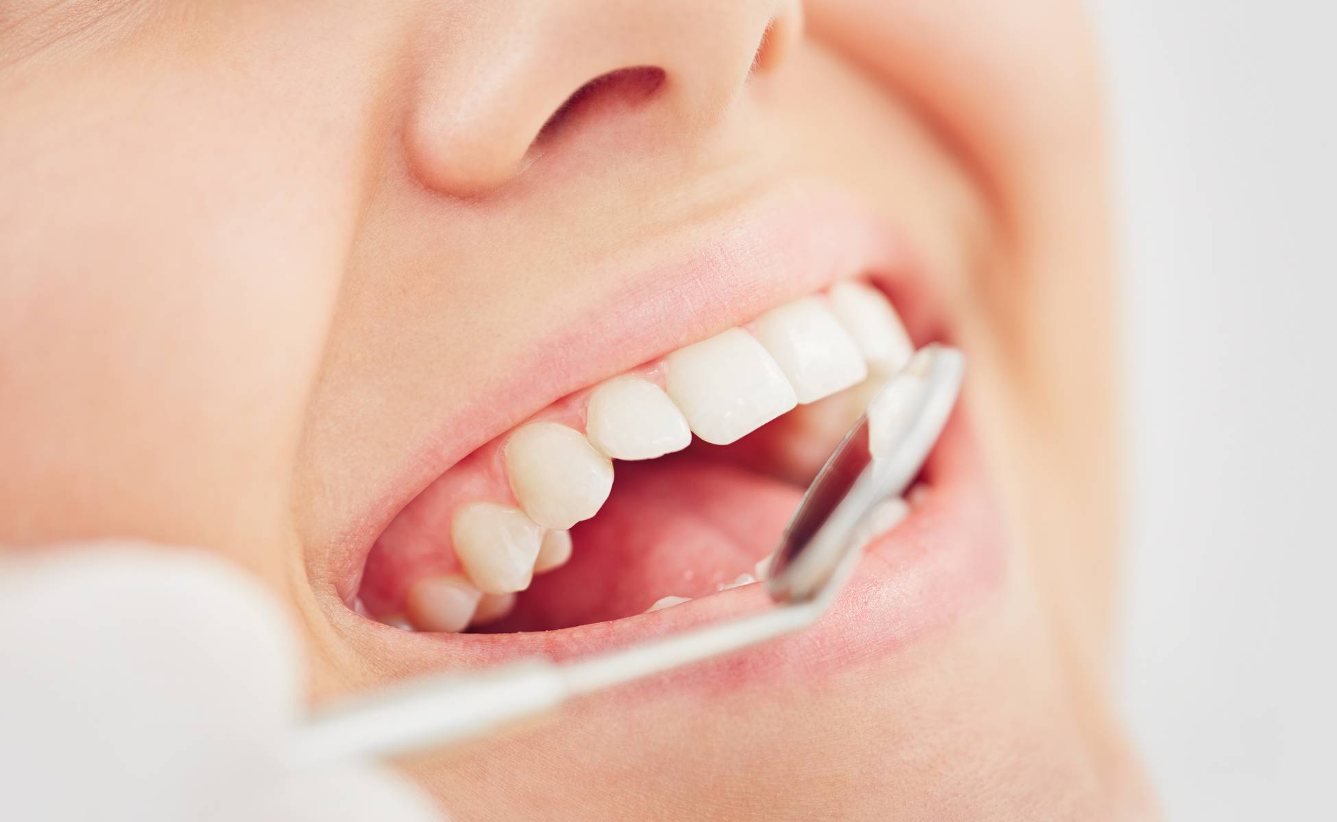 dental check-ups