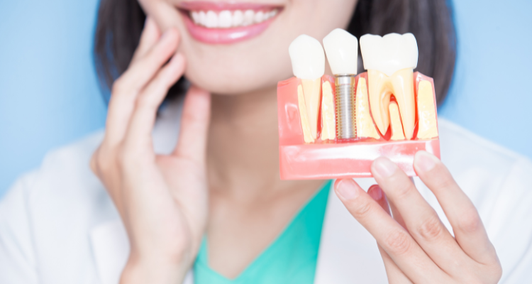 Understanding the Dental Implant Procedure Step-by-Step