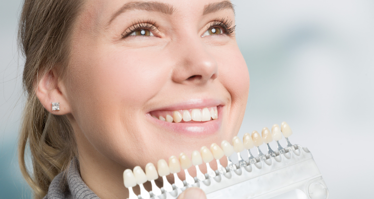 What To Expect From The Lifespan of Veneers